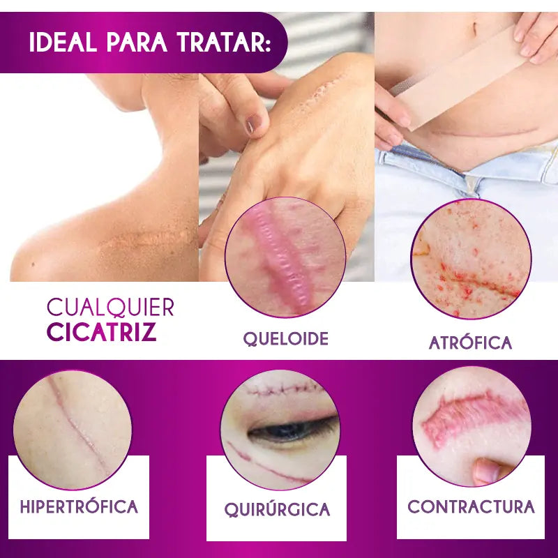 CINTA ANTI CICATRICES [PV1-WHATSAPP-MEGAOFERTAPLUS]