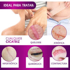 CINTA ANTI CICATRICES [PV1-WHATSAPP-MEGAOFERTAPLUS]
