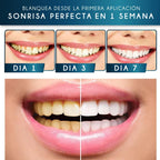CREMA DENTAL ULTRABLANQUEADORA [PV1-WHATSAPP-MEGAOFERTAPLUS]